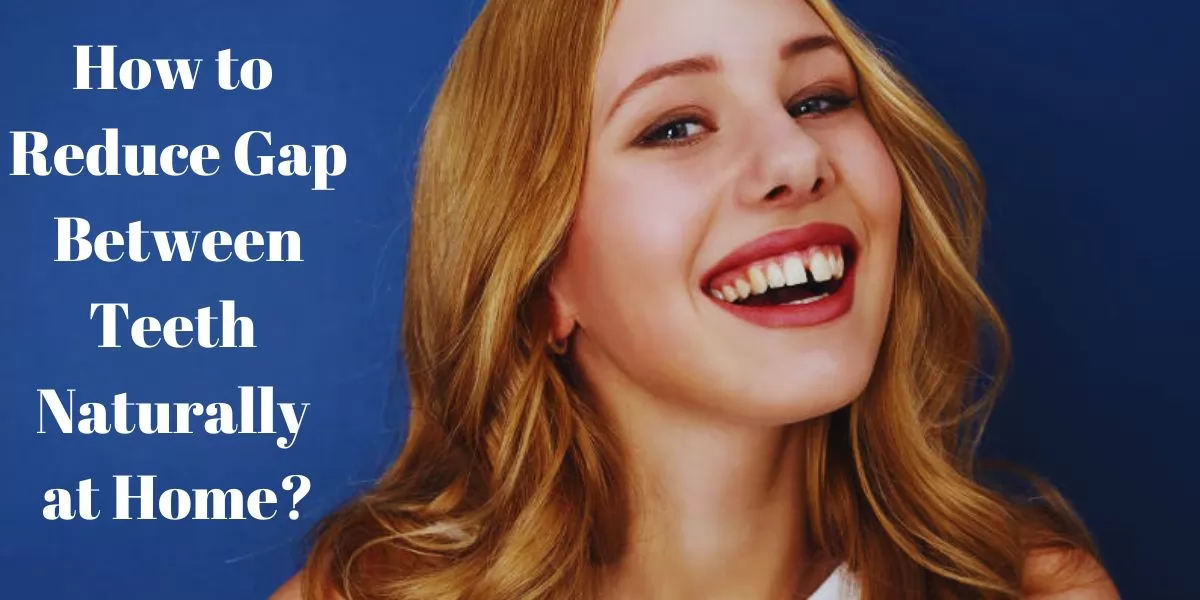 How to reduce gap between teeth naturally at home