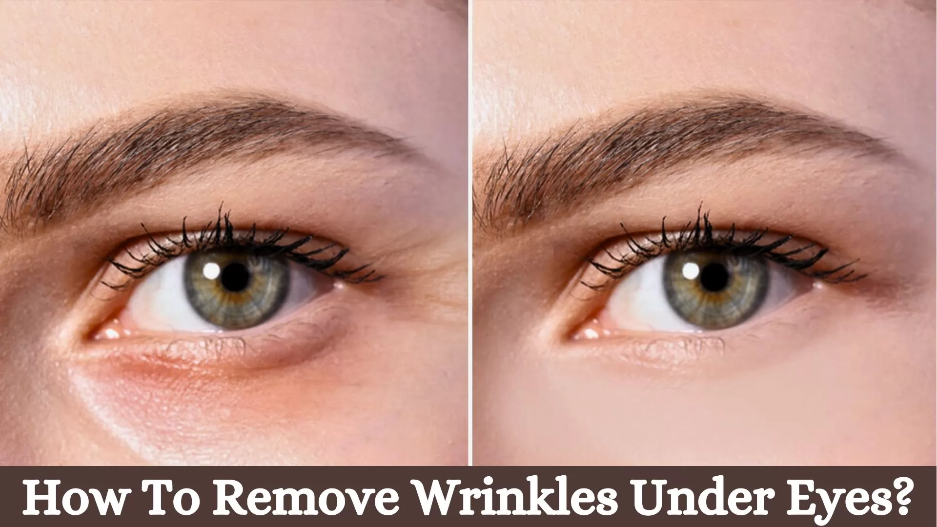 How To Remove Wrinkles Under Eyes? 